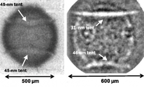 Radiographs of the capsule perturbations 